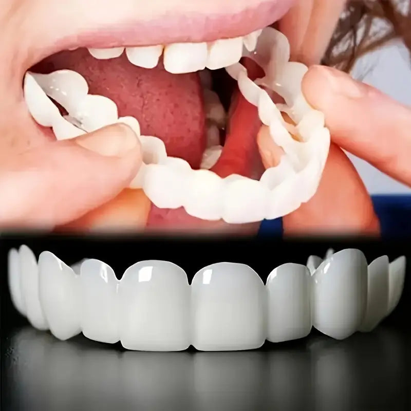 2 Pairs Realistic Dental Veneers – Upper & Lower Teeth, Natural